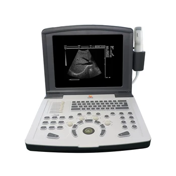 Специално медицинско оборудване за изображения, цветен доплеровский ултразвуков скенер, сонографический апарат, преносим ултразвук